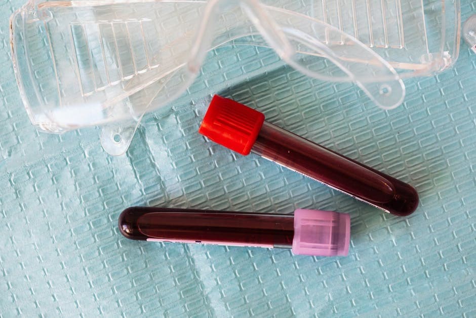 You Need To Know Which Blood Test Required For Pregnancy