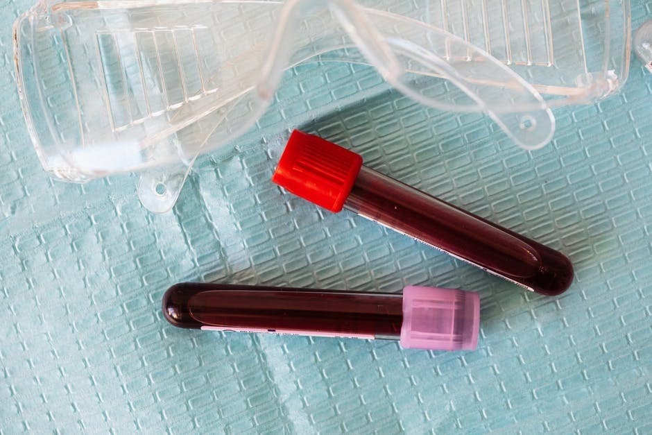 No-Fuss Guide to Preparing for Your Lipid Test in Dubai