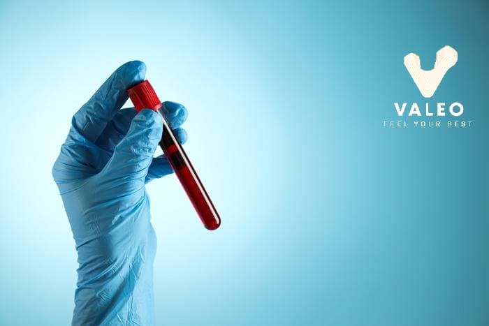 Cost of Blood Tests in Dubai of 10 Annual Panels | Valeo Health 