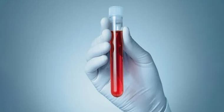 Blood Test At Home in Dubai